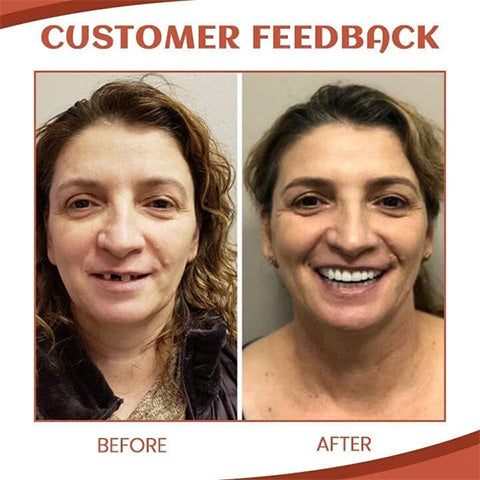 LächelFit™ Flexibler Sicherer Sitz